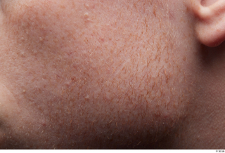 HD Face Skin Fergal cheek face skin pores skin texture…